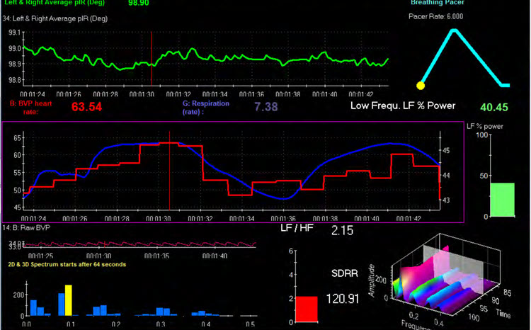 pIR-HEG training screen showing temperature waveform from Biofeedback Institute of Toronto